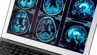 Scientists discover cure for Alzheimer’s disease and a way to restore memory – Nature