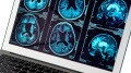 Scientists discover cure for Alzheimer’s disease and a way to restore memory – Nature