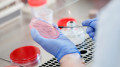 Anthrax detected in Shymkent and several other regions of Kazakhstan