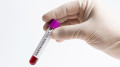 Ministry of Health addresses Kazakhstanians due to hantavirus