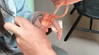 bitten by a snake