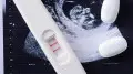 Almaty resident claims data leak after pregnancy termination - Ministry of Health response