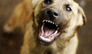 Қостанайда ит екі айлық нәрестені тістеп алған