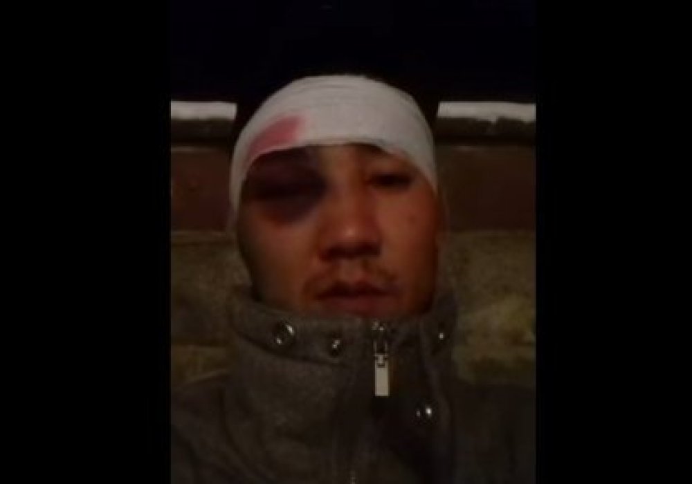 Полицейлерден соққы көрдім деп мәлімдеген алматылықтың ісін ІІД тексеріп жатыр