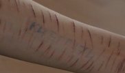 Қолын тілгілеп тастаған ақтаулық оқушы "Синий кит" ойыны жайлы айтып берді