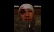 Полицейлерден соққы көрдім деген алматылықтың ісі: ІІБ қызметкерлерінің әрекетінде заңбұзушылық жоқ