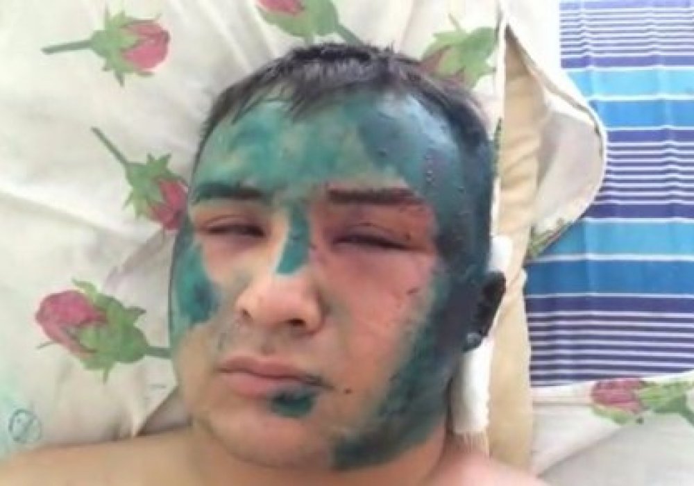 Төрт адамнан соққы көріп, жансақтау бөлімінен бірақ шыққан жәбірленуші сотталушыға айналды