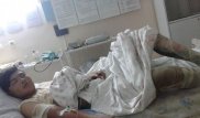 Қойдың басын үйітпек болған жасөспірім күйік шалып, ауыр халде жатыр