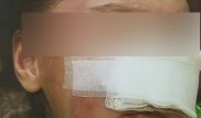 Алматы облысында өгей әкесі үш жасар қызын оңдырмай сабап тастаған