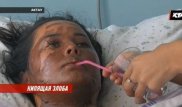 Қайнап тұрған майды қыздың бетіне шашып жіберген маңғыстаулық сотталды
