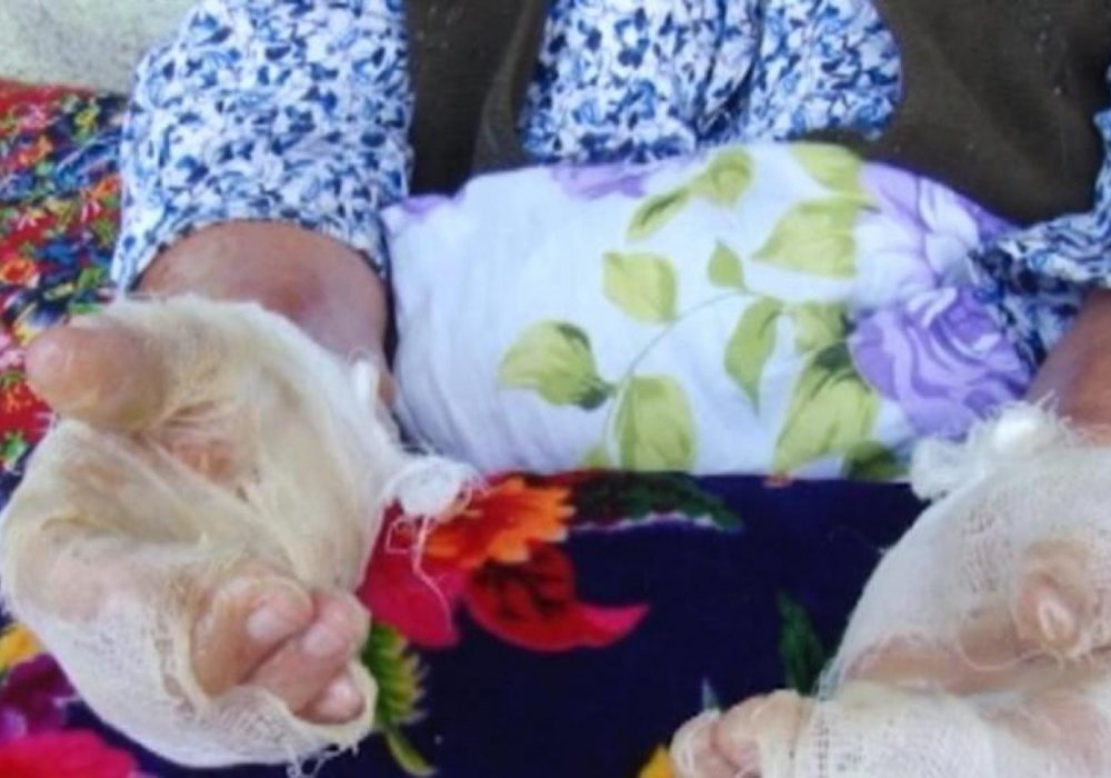 Түркістан облысында белгісіз ер адам екі рет егде жастағы әйелді өртеп жібермекші болған