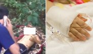 "Бассүйегіне пластика қою қажет" - Дәрігерлер әкесі таспен ұрған баланың жағдайы жайлы