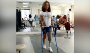 Жол апатынан аяғынан айырылған алматылық қызға протез салу үшін ақша жиналды