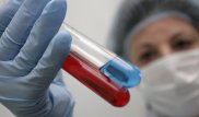 Сібір жарасын жұқтырмау үшін не істеу керек? Дәрігерлер кеңесі